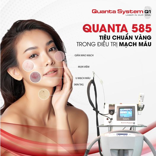 quanta-585-tieu-chuan-vang-trong-dieu-tri-mach-mau-va-hon-the-nua