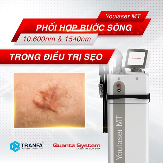 youlaser-mt-phoi-hop-buoc-song-10-600nm-1540nm-trong-dieu-tri-seo