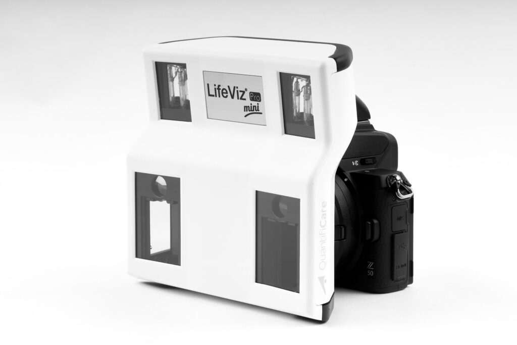 máy phân tích da 3d - Lifeviz mini pro